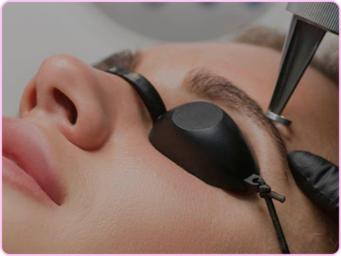 Лазерное удаление татуажа >